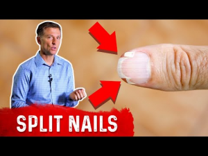repairing your nails at home